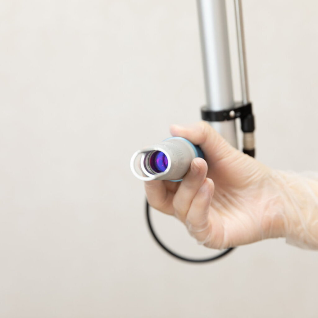 QスイッチNdYAGレーザ