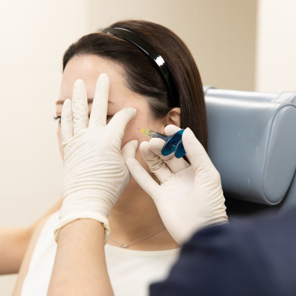 たるみのヒアルロン酸注射の様子