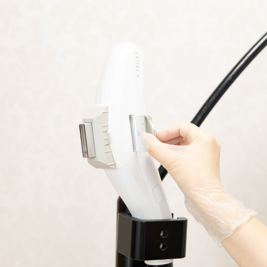 セレックVのフィルターを交換しているところ