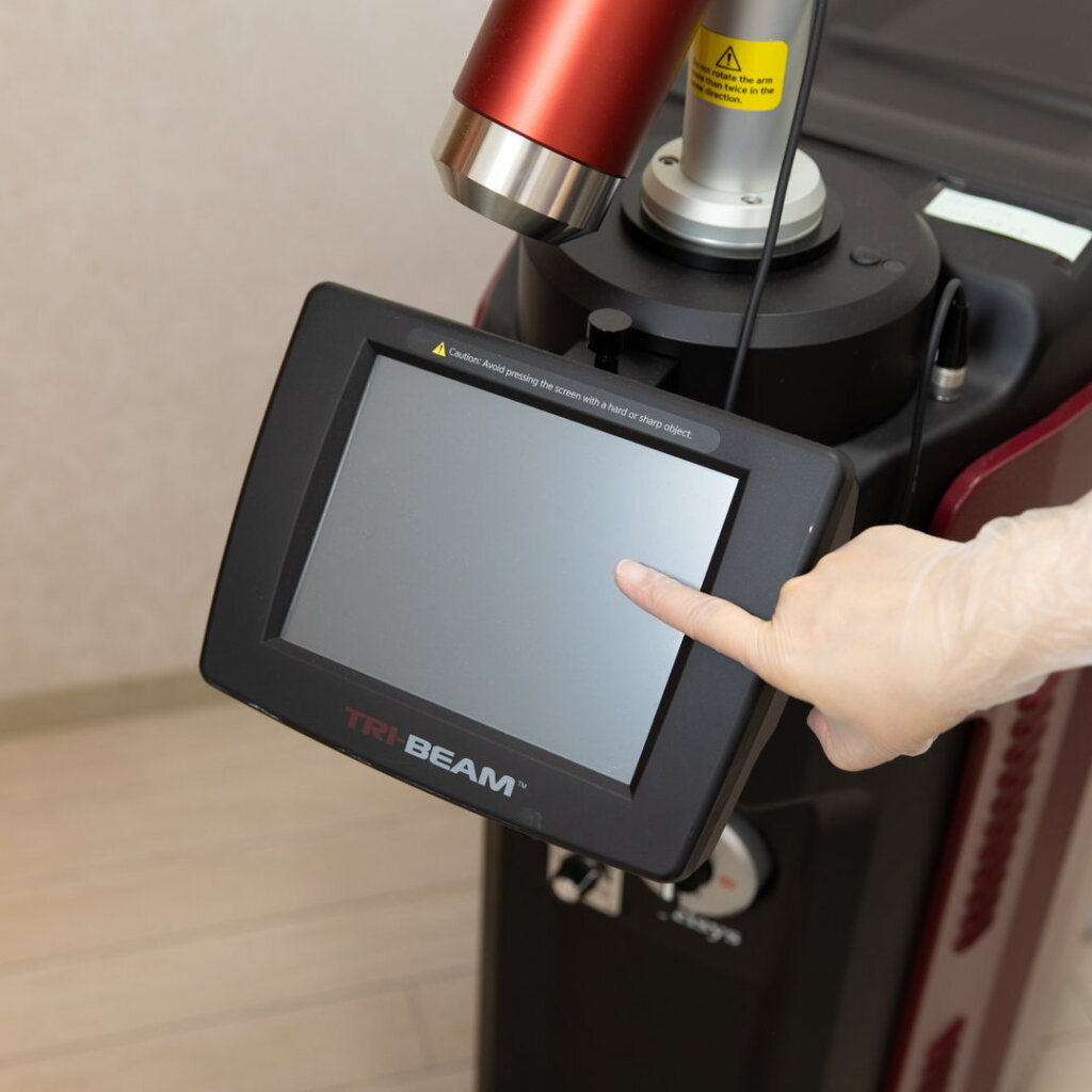 ヤグレーザーの設定を変更しているところ