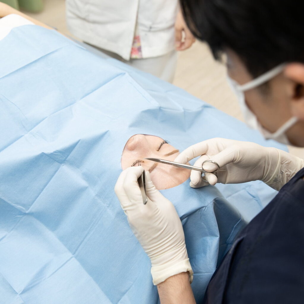 埋没法の手術をしている様子