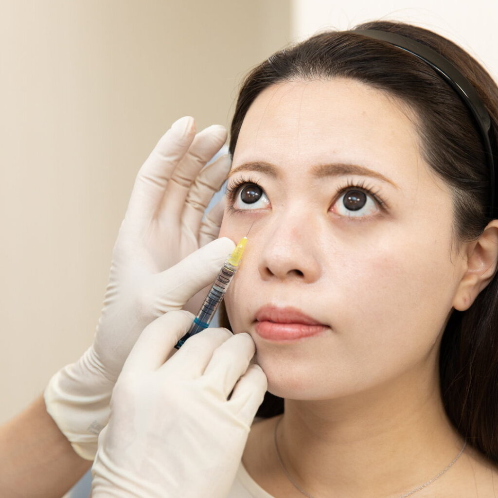 涙袋のヒアルロン酸注射を鹿児島の美容外科でしている様子