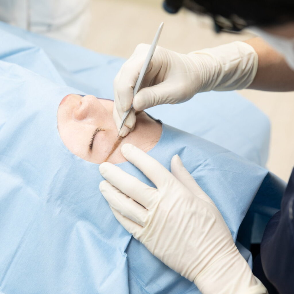 眉下切開の手術をしている様子