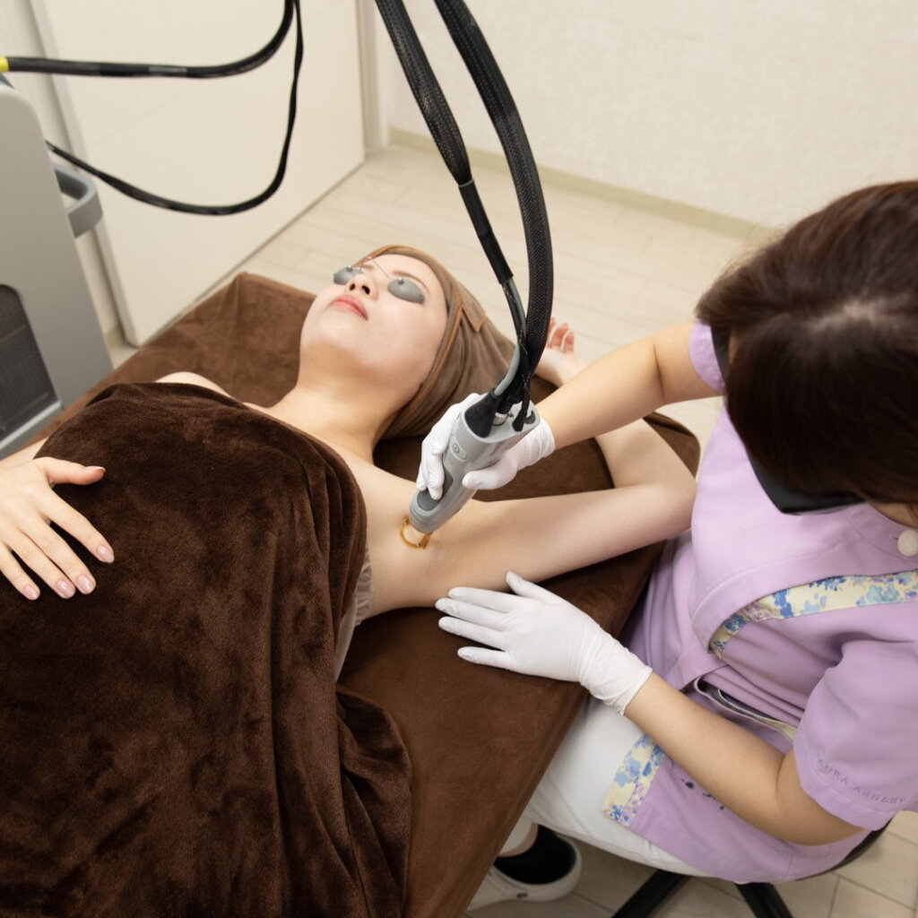 脇の脱毛の施術をしている様子