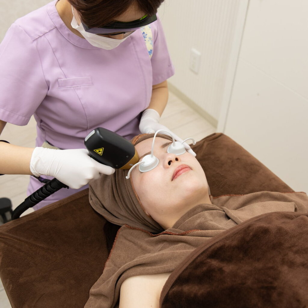 蓄熱式脱毛機で顔の脱毛をしている様子