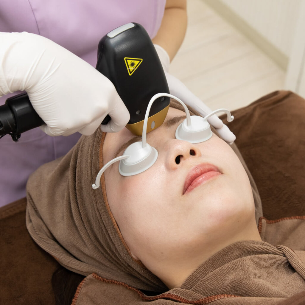 チタニウムリフトを額にしているところ