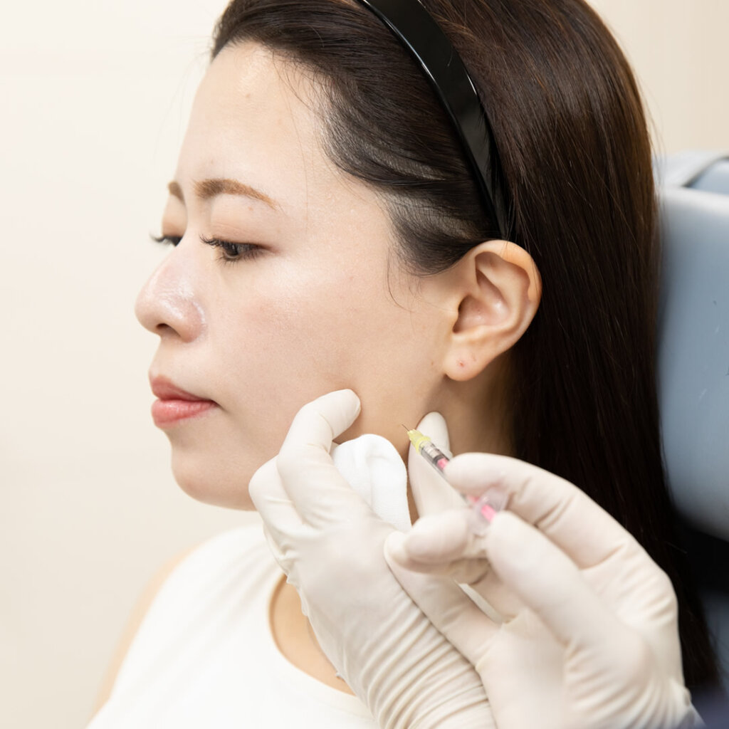 ボトックス注射の施術をしているところ