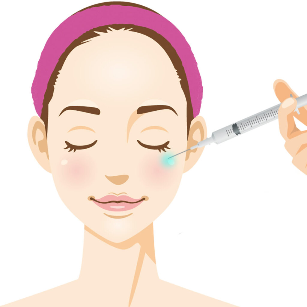 リモデリングヒアルのイラスト