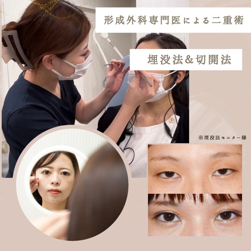 二重整形のバナー