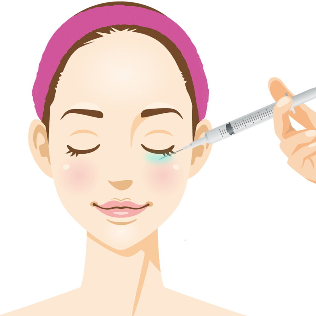 涙袋にヒアルロン酸を注入しているイラスト
