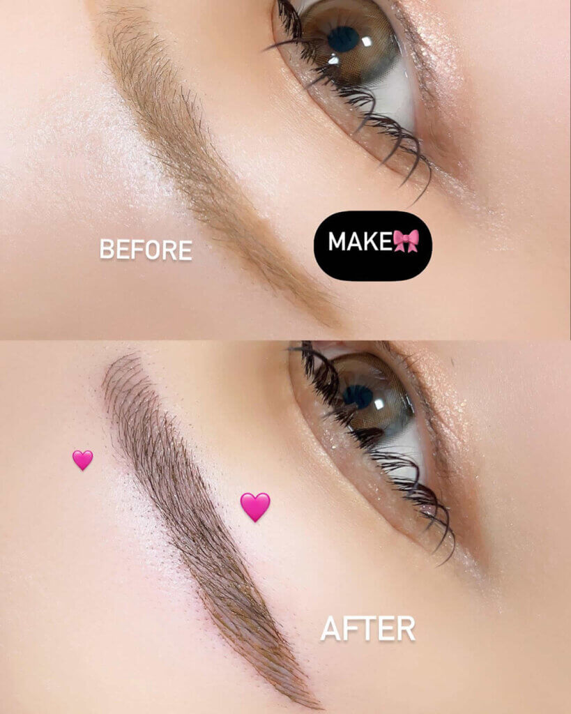 眉毛のアートメイクの症例写真 (1)