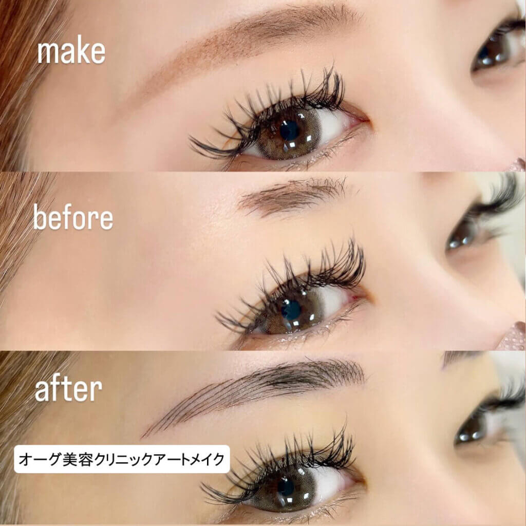 眉毛のアートメイクの症例写真 (11)