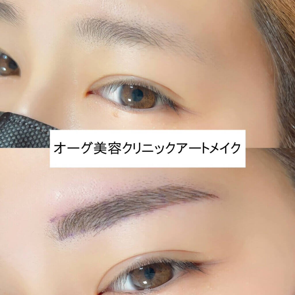 眉毛のアートメイクの症例写真 (12)