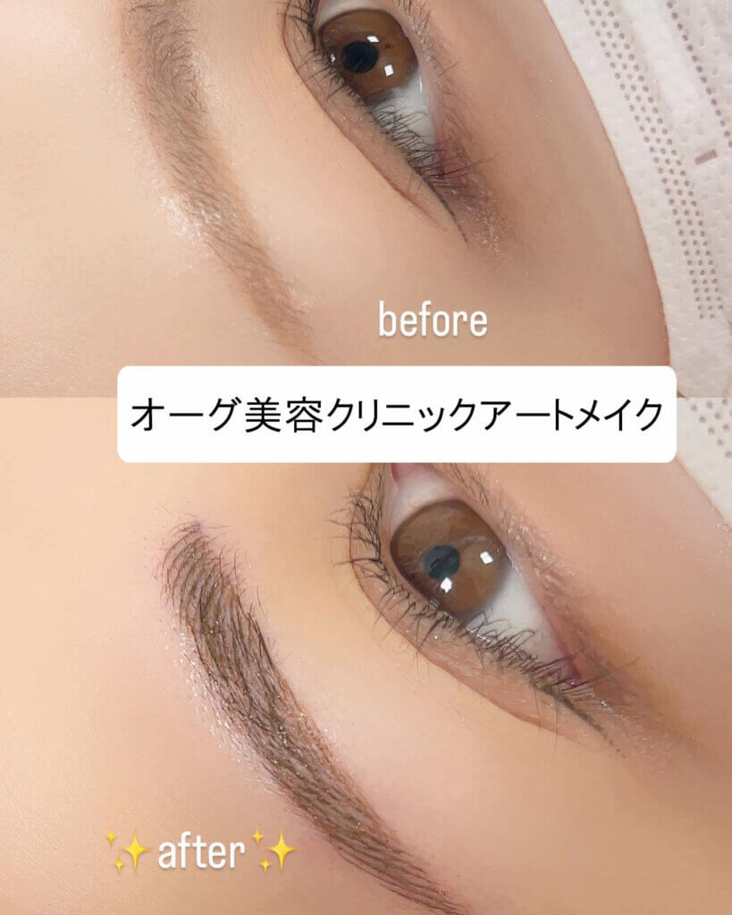 眉毛のアートメイクの症例写真 (13)