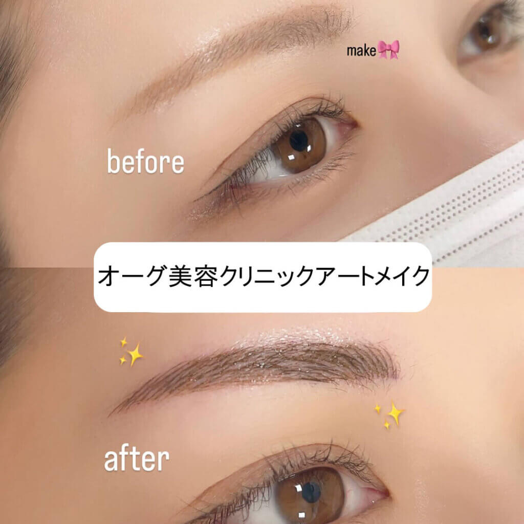 眉毛のアートメイクの症例写真 (14)