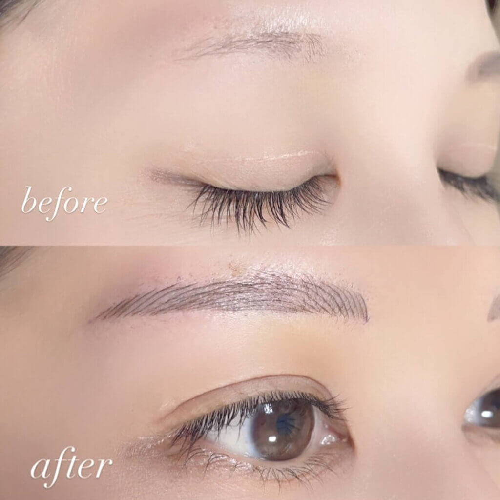 眉毛のアートメイクの症例写真 (3)