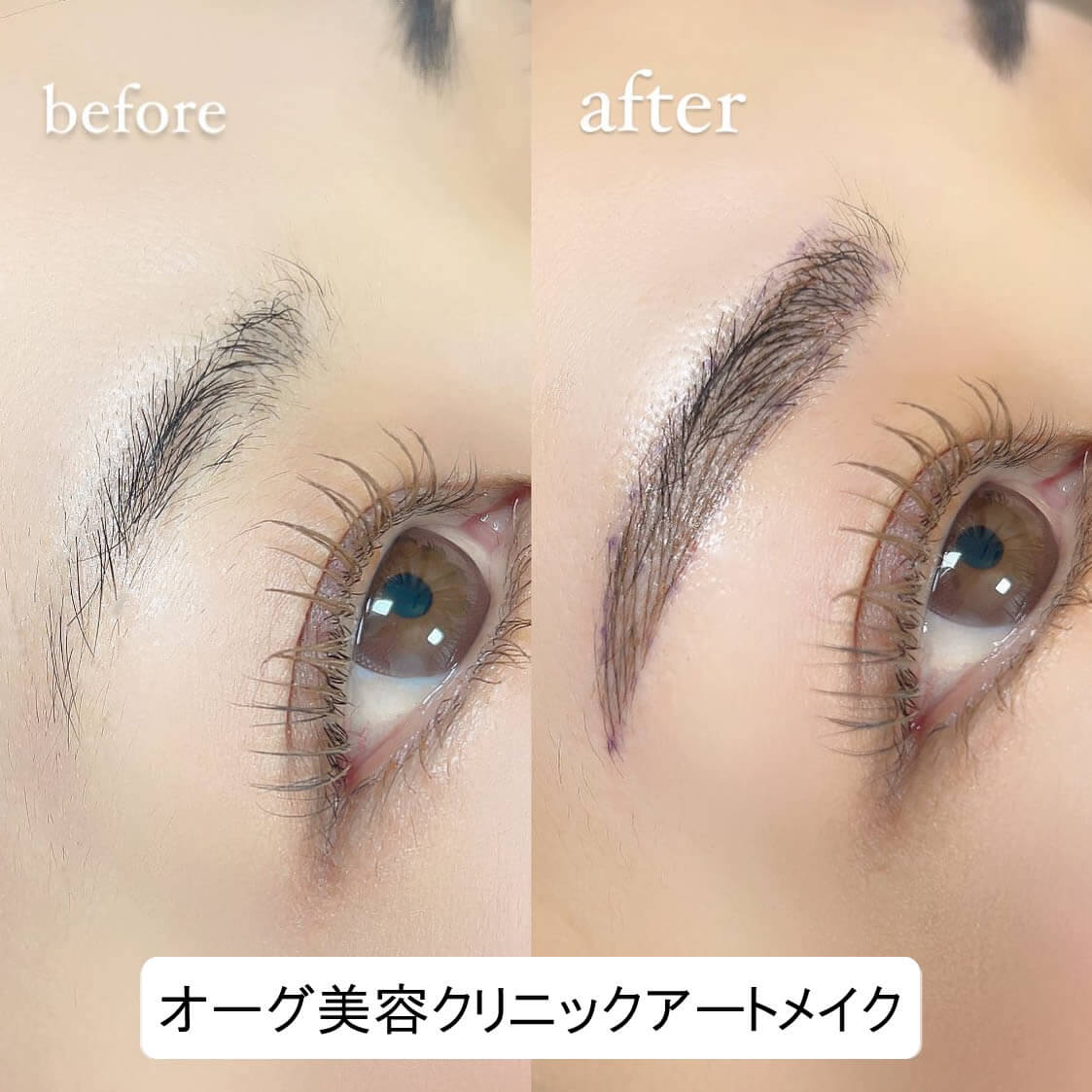 眉毛のアートメイクの症例写真 (4)