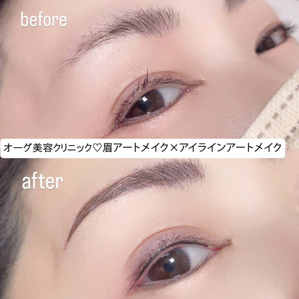 眉毛のアートメイクの症例写真 (5)