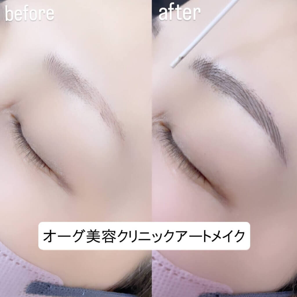 眉毛のアートメイクの症例写真 (7)