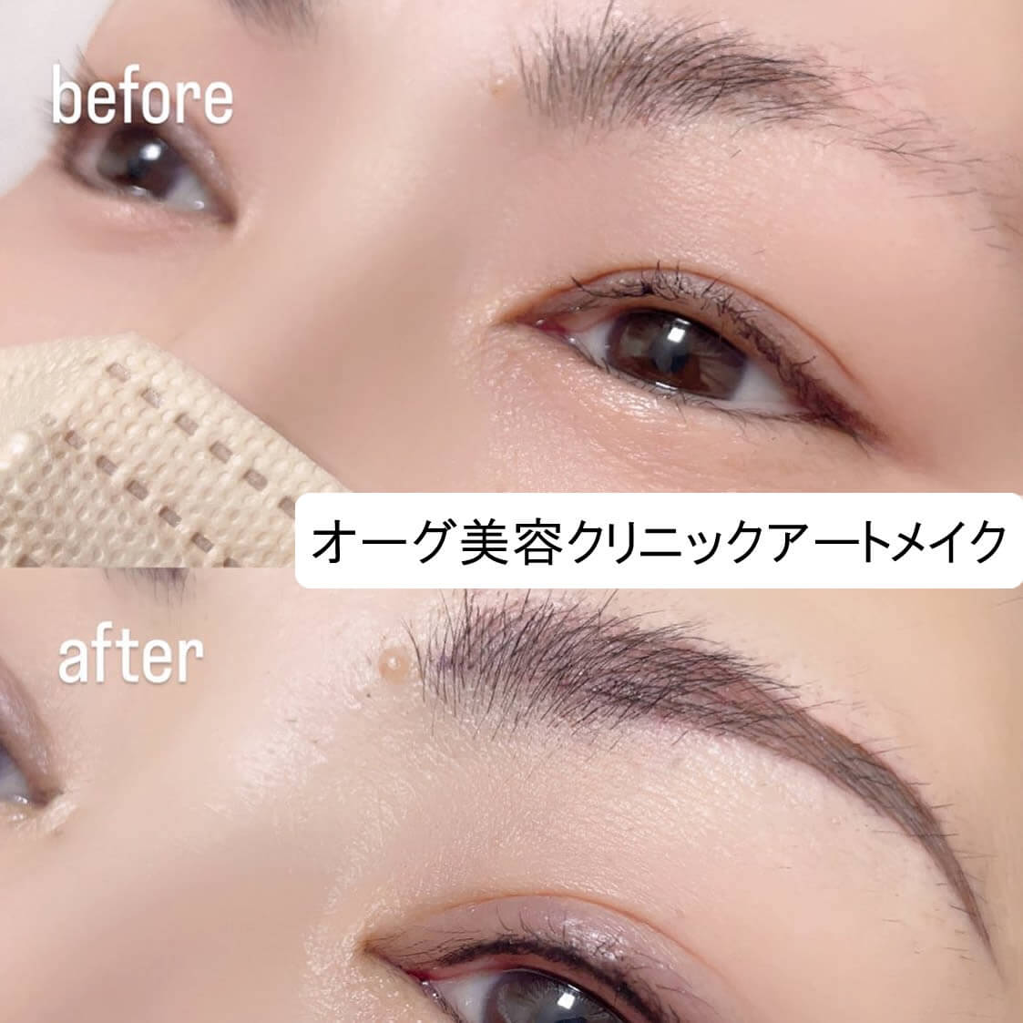 眉毛のアートメイクの症例写真 (8)