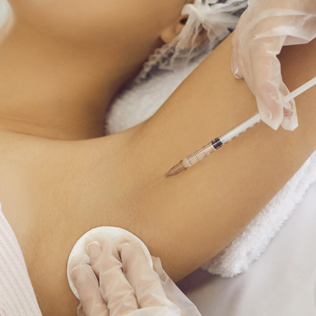 脇にボトックスを注入している様子