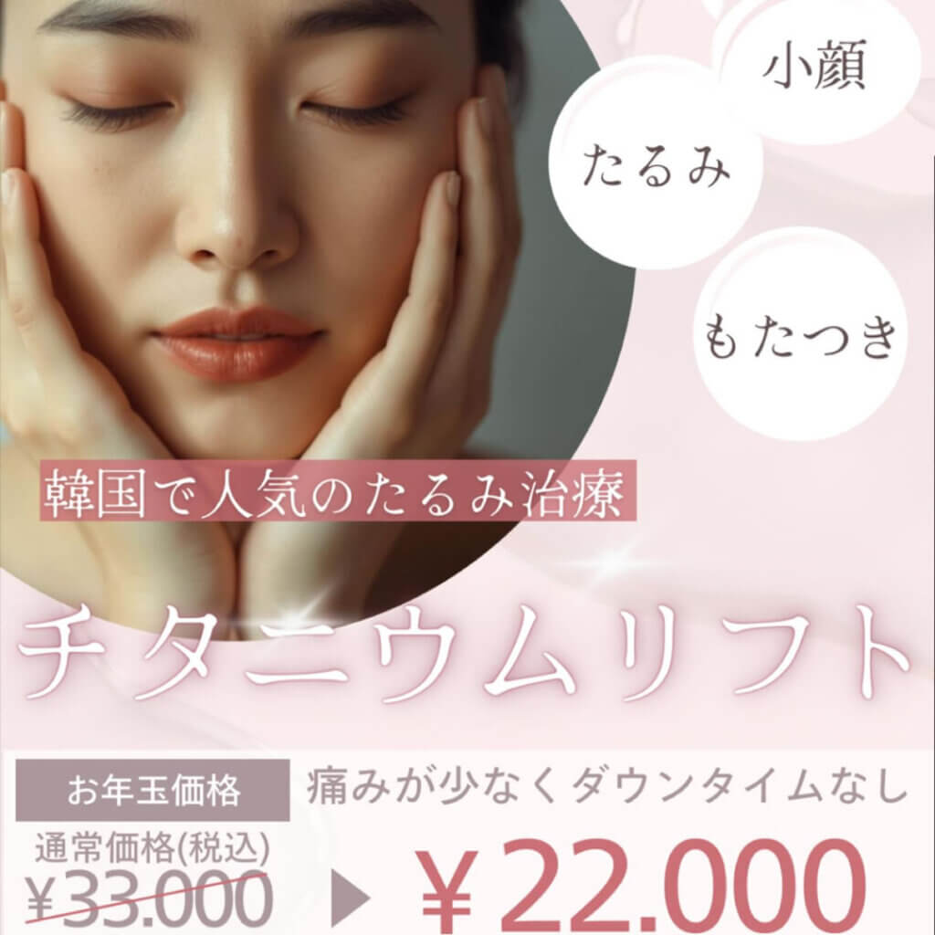 チタニウムリフトのバナー